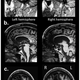 Illustration for article titled Rare neurological patient shows that self-awareness does not require a complex brain